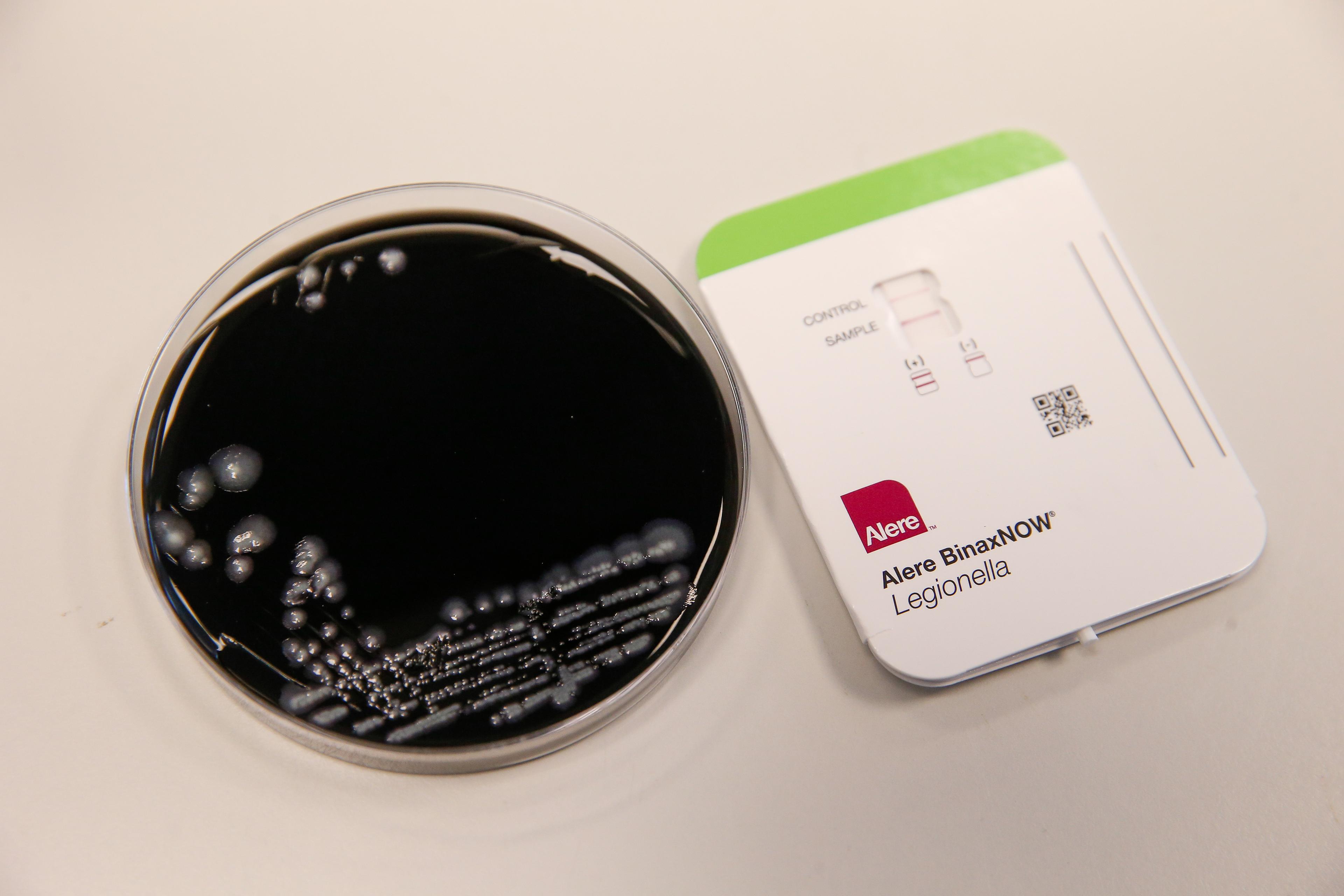 legionella-belga